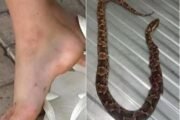 Mulher vítima de picada de jararaca é transferida de Uauá para Juazeiro